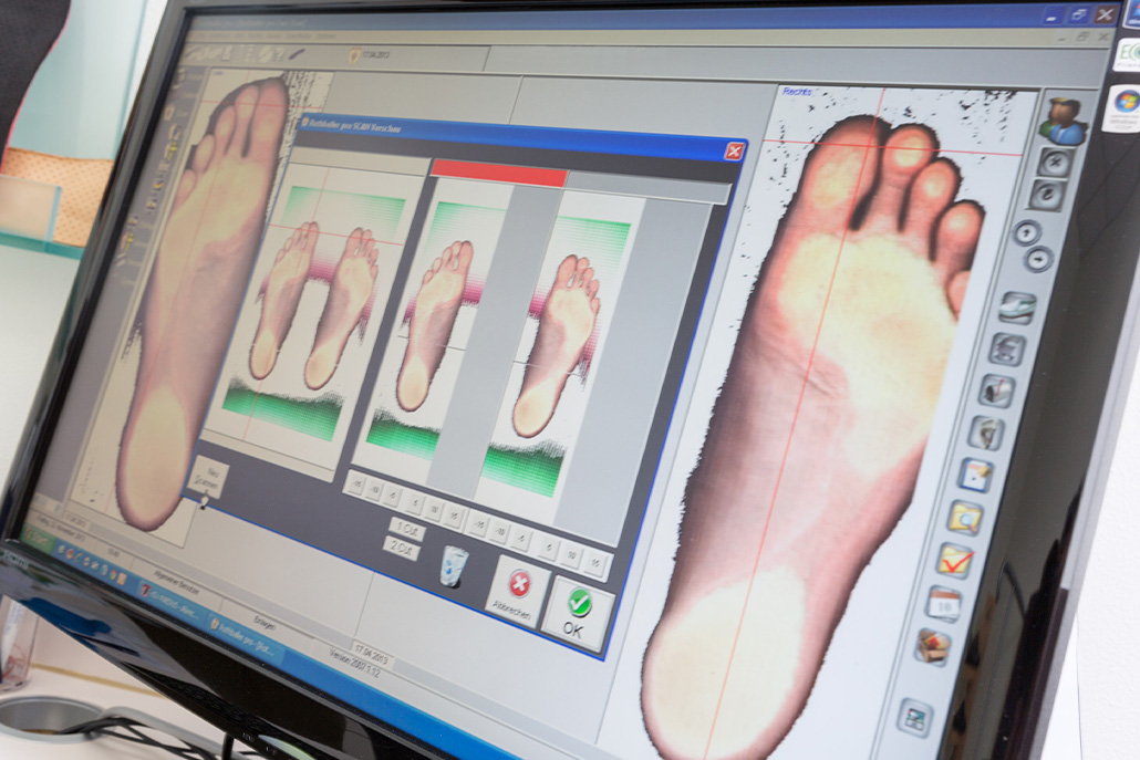 Analyse des Fußscans auf Druckstellen und Problembereiche
