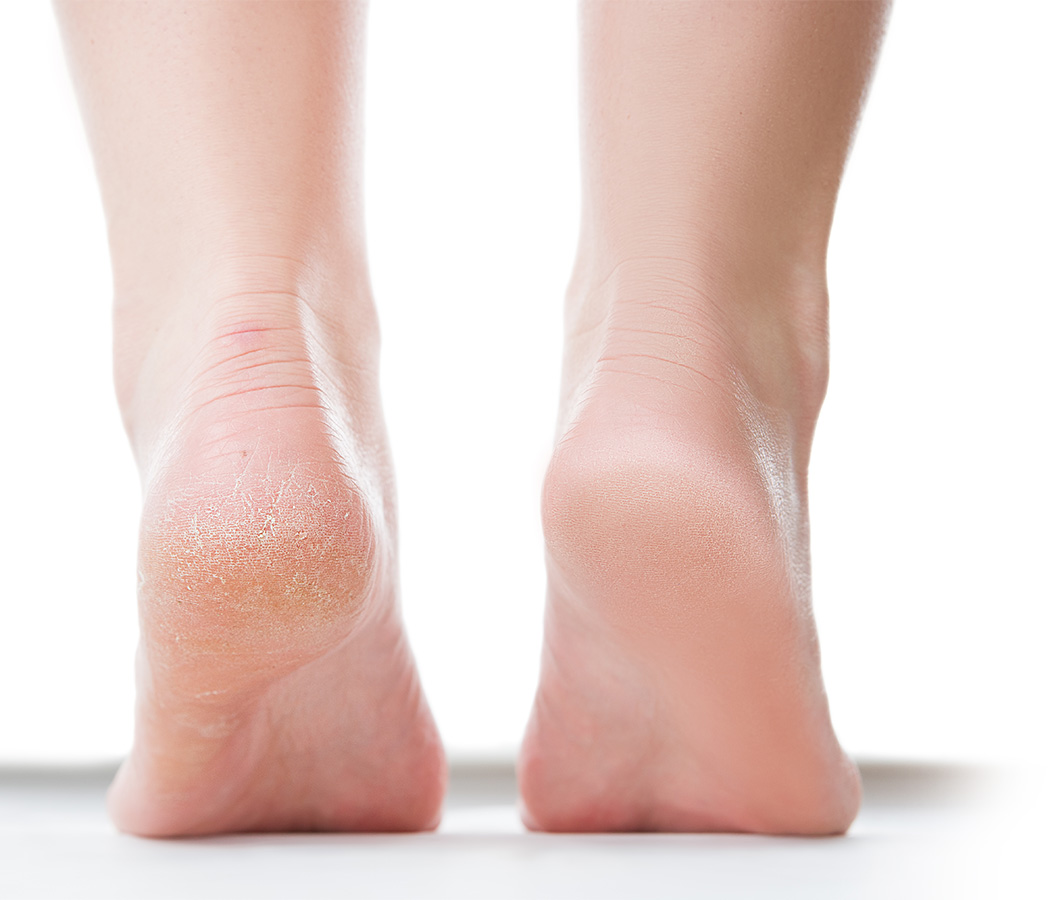 Fußpflege bei Auth Orthopädie